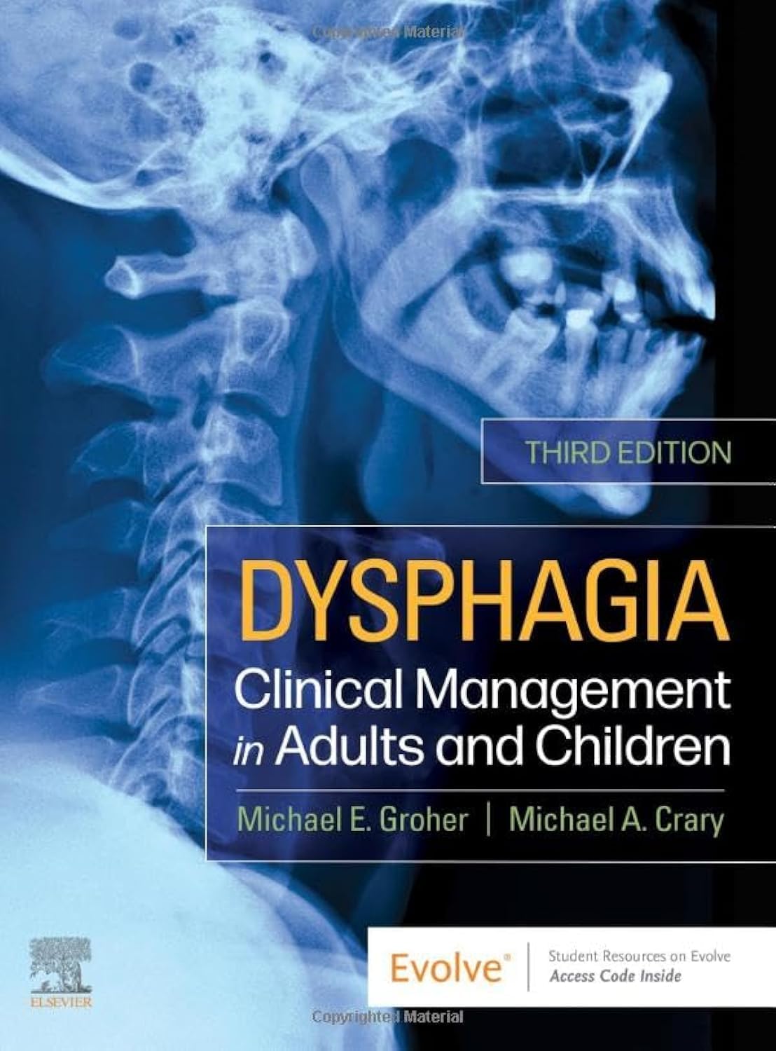 Dysphagia