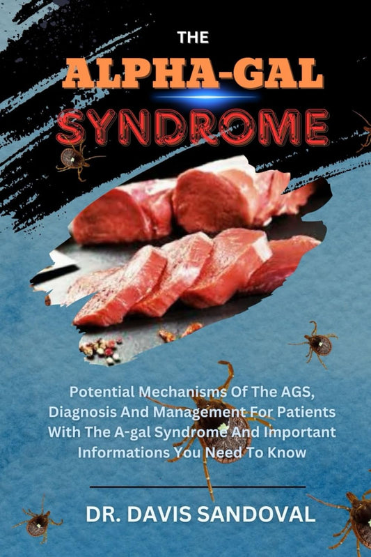 The Alpha-Gal Syndrome: Potential Mechanisms Of The AGS, Diagnosis And Management For Patients With The Α-gal Syndrome And Important Informations You Need To Know